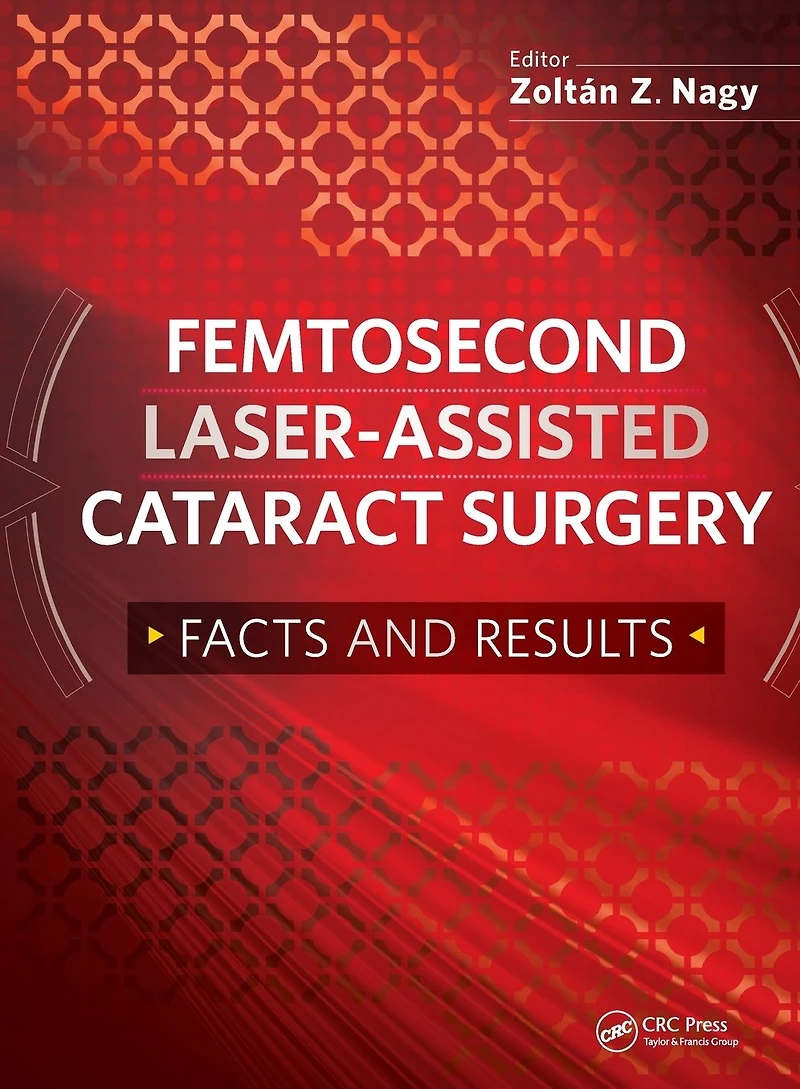 Femtosecond Laser-Assisted Cataract Surgery: Facts and Results