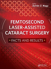 Femtosecond Laser-Assisted Cataract Surgery: Facts and Results
