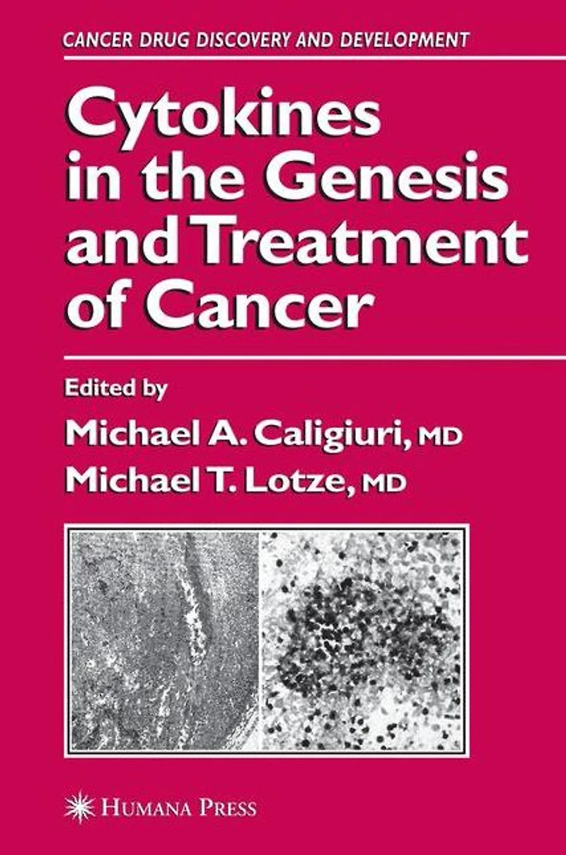 Cytokines the Genesis and Treatment of Cancer
