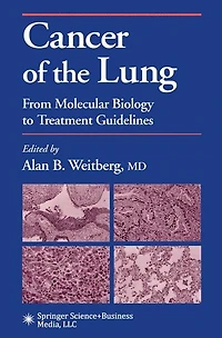 Cancer of the Lung: From Molecular Biology to Treatment Guidelines