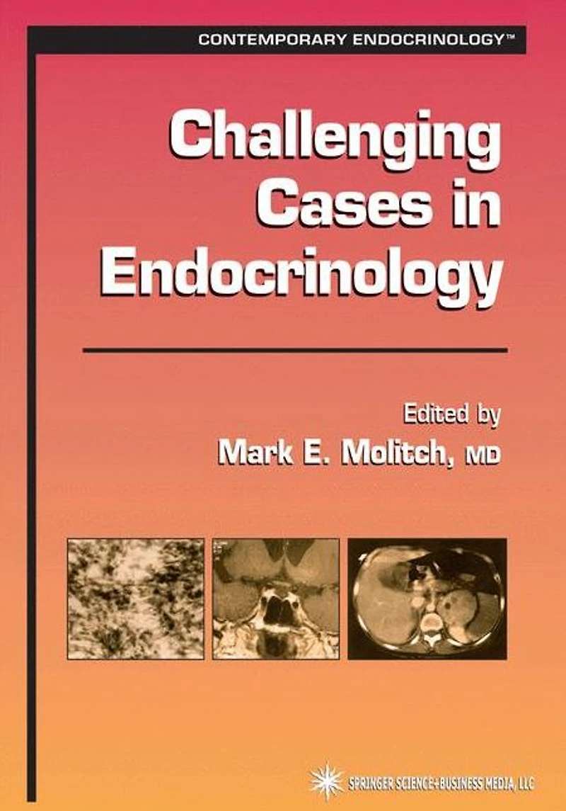 Challenging Cases Endocrinology