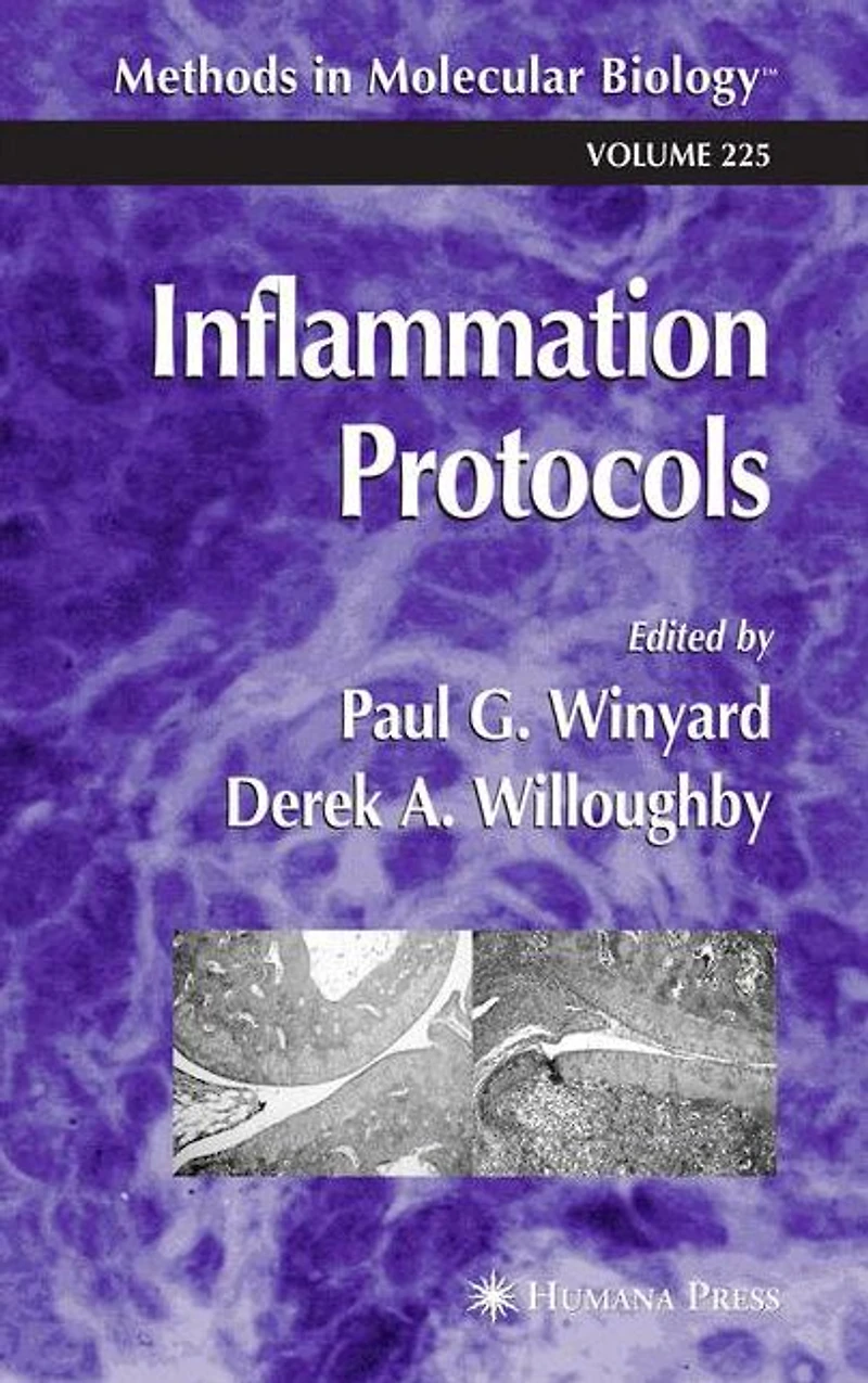 Inflammation Protocols