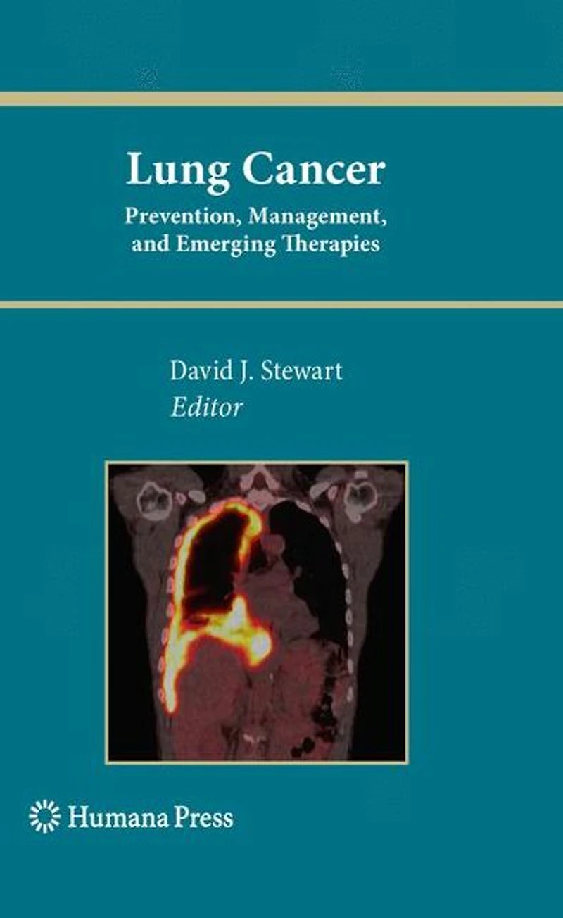 Lung Cancer:: Prevention, Management, and Emerging Therapies