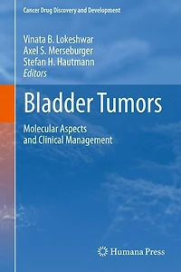 Bladder Tumors:: Molecular Aspects and Clinical Management