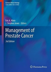 Management of Prostate Cancer