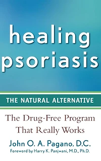 Healing Psoriasis: The Natural Alternative
