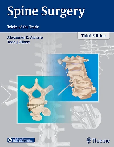 Spine Surgery: Tricks of the Trade