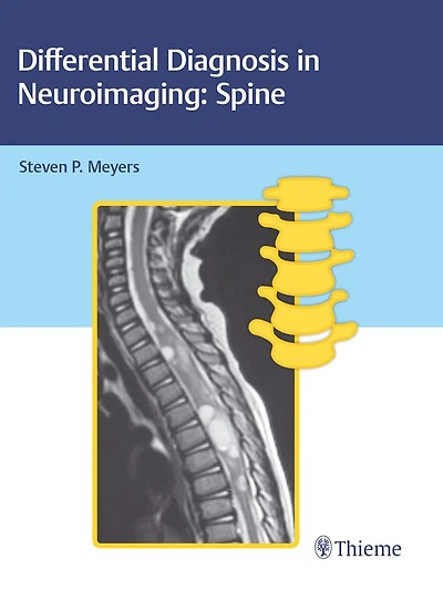 Differential Diagnosis in Neuroimaging: Spine: Spine