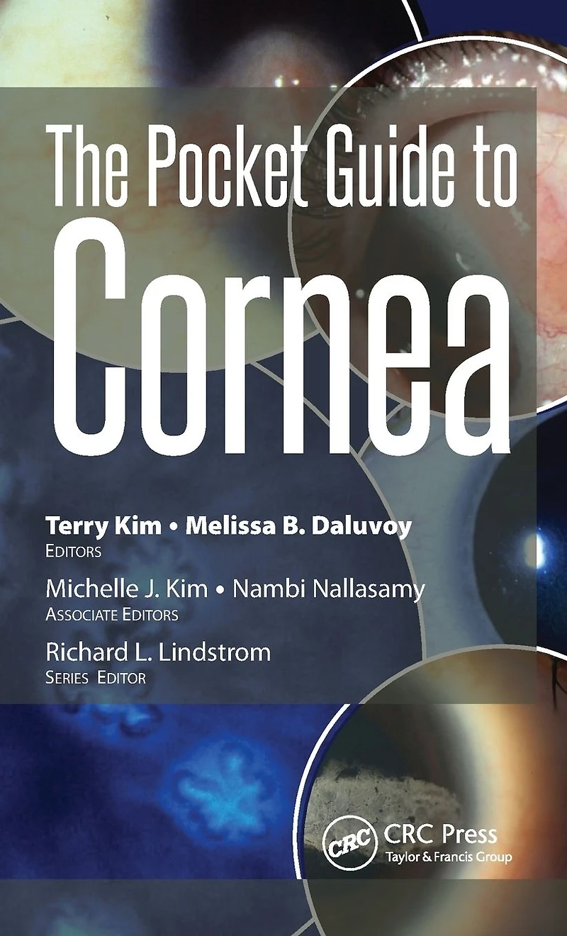 The Pocket Guide to Cornea
