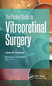 The Pocket Guide to Vitreoretinal Surgery