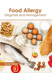 Food Allergy: Diagnosis and Management