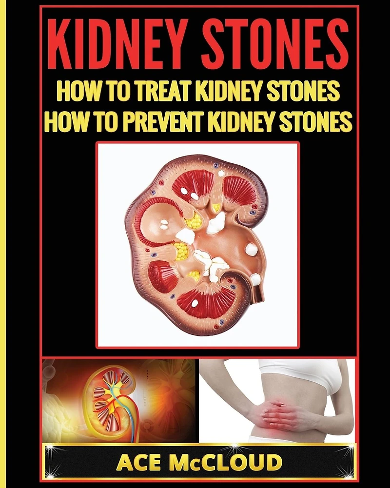 Kidney Stones: How To Treat Prevent Stones