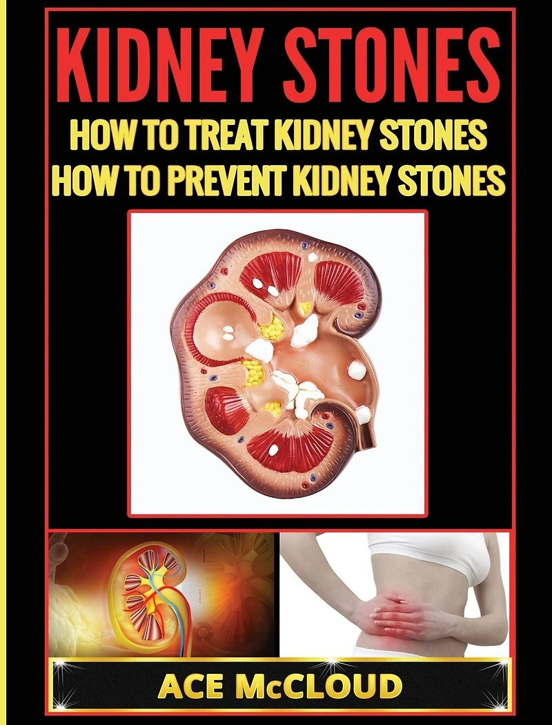 Kidney Stones: How To Treat Prevent Stones