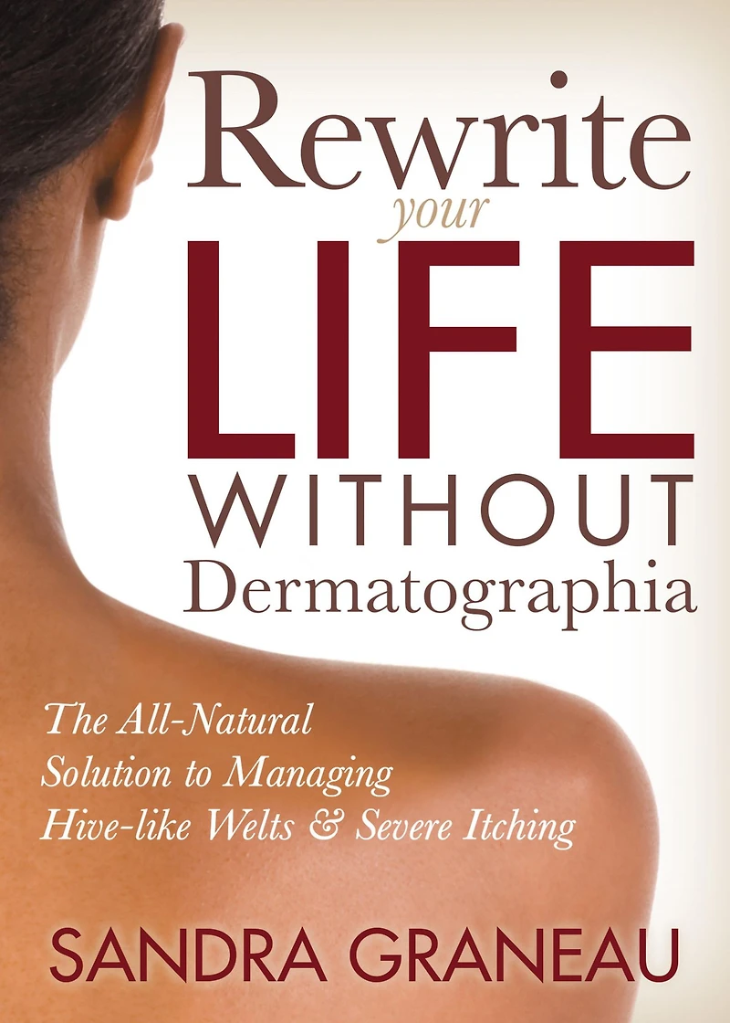 Rewrite Your Life Without Dermatographia: The All-Natural Solution to Managing Hive-like Welts & Severe Itching