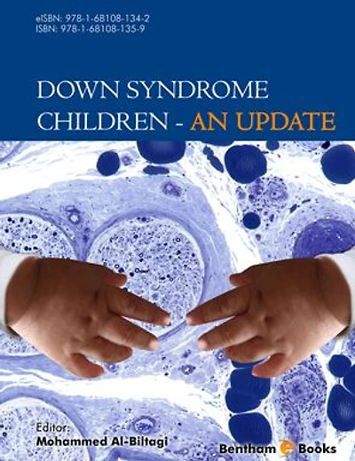 Down Syndrome Children - An Update