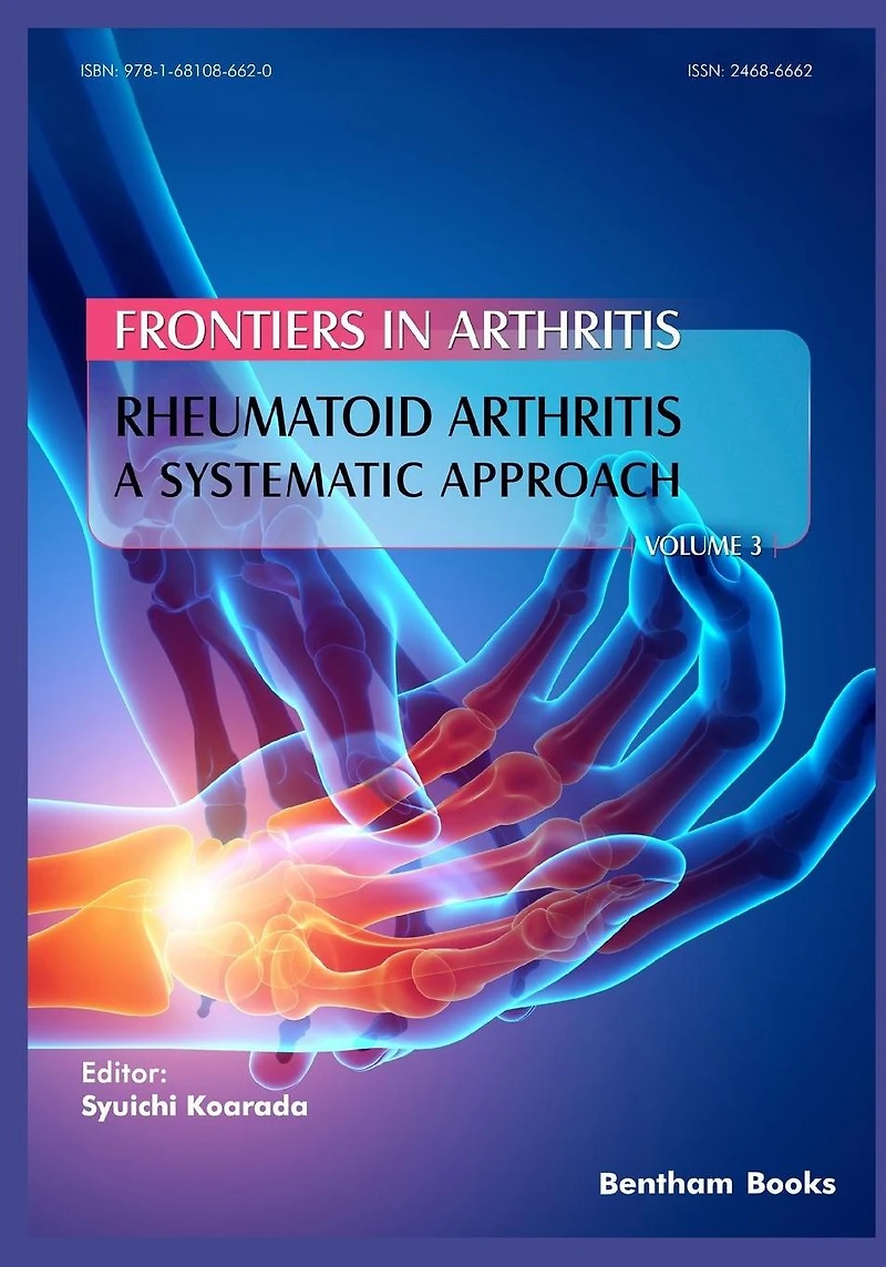 Rheumatoid Arthritis: A systematic approach