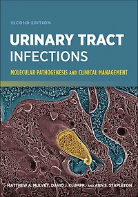 Urinary Tract Infections: Molecular Pathogenesis and Clinical Management