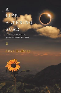 A Life Altering Scar: How Family, Faith, and Laughter Helped