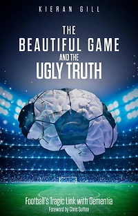 the Beautiful Game and Ugly Truth: Football's Tragic Link with Dementia