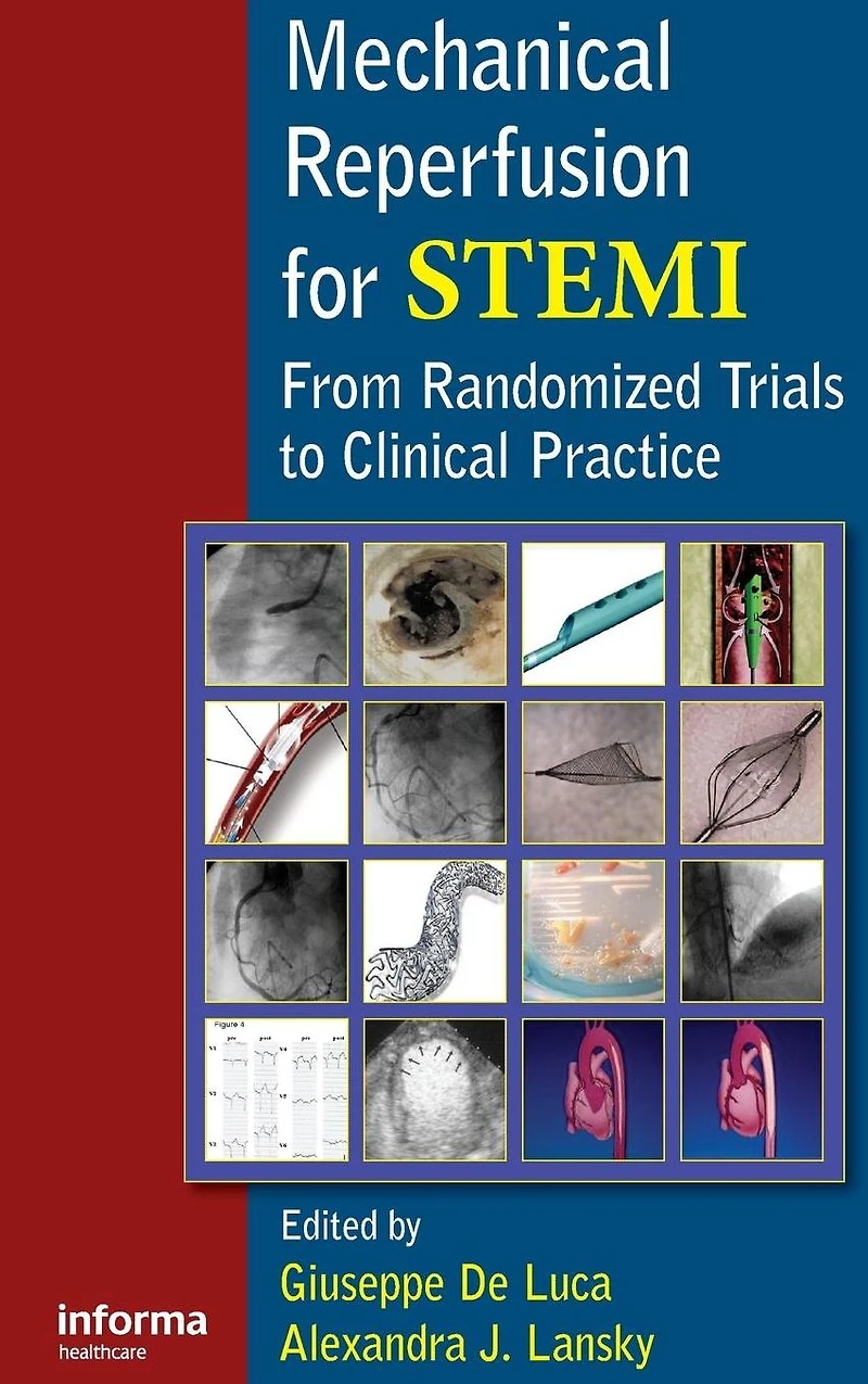 Mechanical Reperfusion for STEMI: From Randomized Trials to Clinical Practice