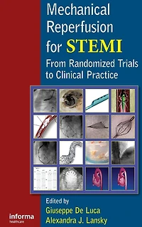 Mechanical Reperfusion for STEMI: From Randomized Trials to Clinical Practice