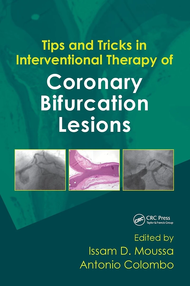 Tips and Tricks Interventional Therapy of Coronary Bifurcation Lesions