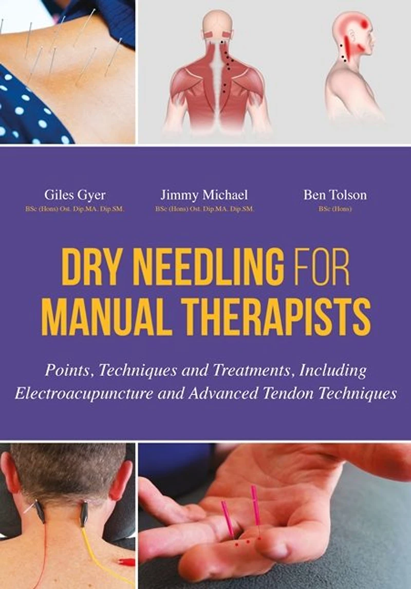 Dry Needling for Manual Therapists: Points, Techniques and Treatments, Including Electroacupuncture Advanced Tendon