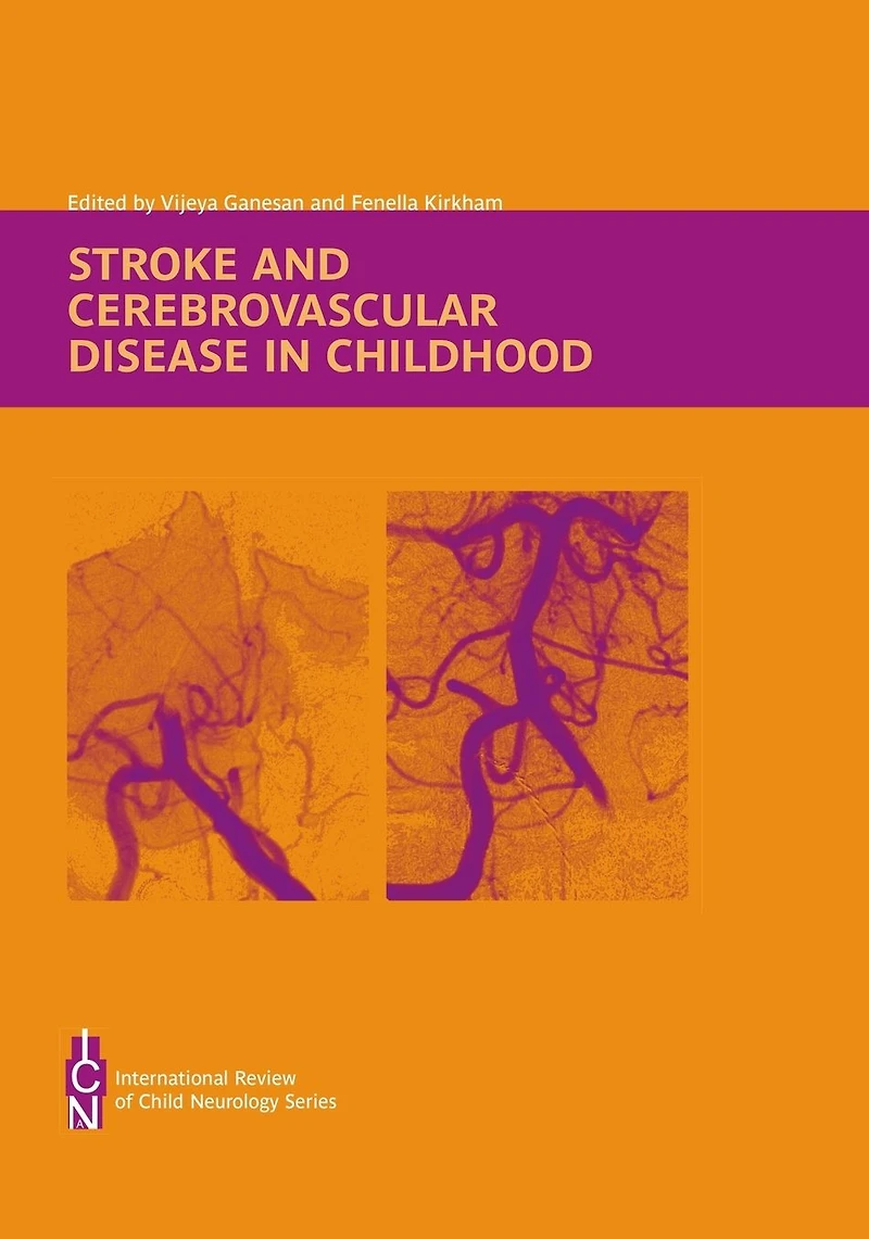 Stroke and Cerebrovascular Disease Childhood