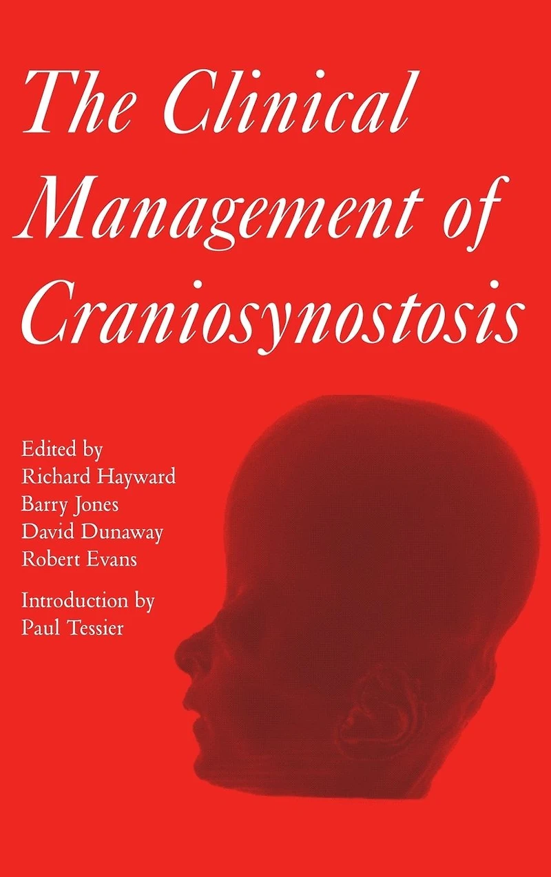 Clinical Management of Craniosynostosis