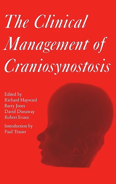 Clinical Management of Craniosynostosis