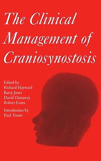 Clinical Management of Craniosynostosis
