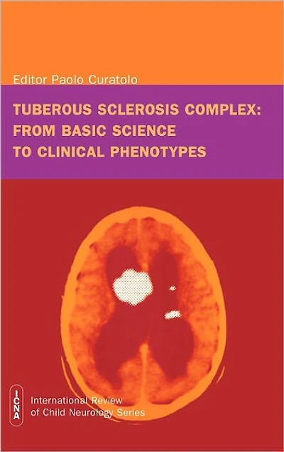 Tuberous Sclerosis Complex: From Basic Science to Clinical Phenotypes