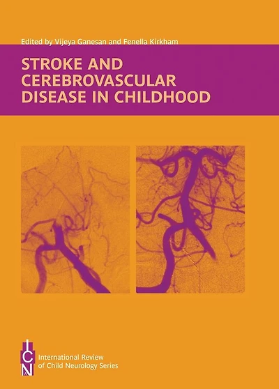 Stroke and Cerebrovascular Disease Childhood