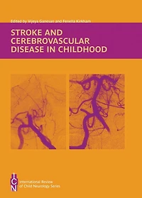 Stroke and Cerebrovascular Disease Childhood