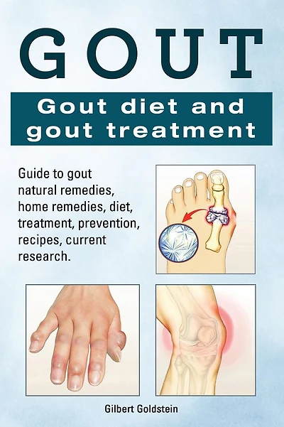 Gout. Gout diet and gout treatment. Guide to gout natural remedies, home remedies, diet, treatment, prevention, recipes, current research.