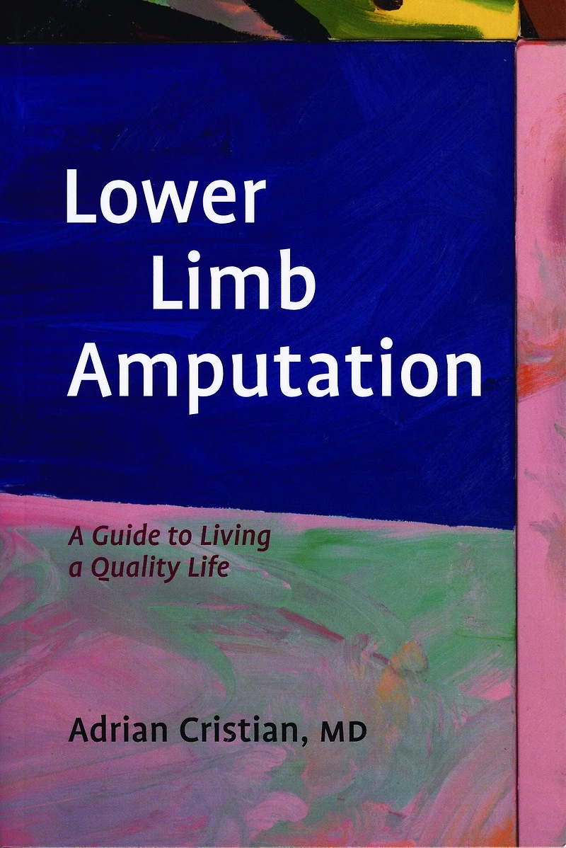 Lower Limb Amputation: A Guide to Living a Quality Life