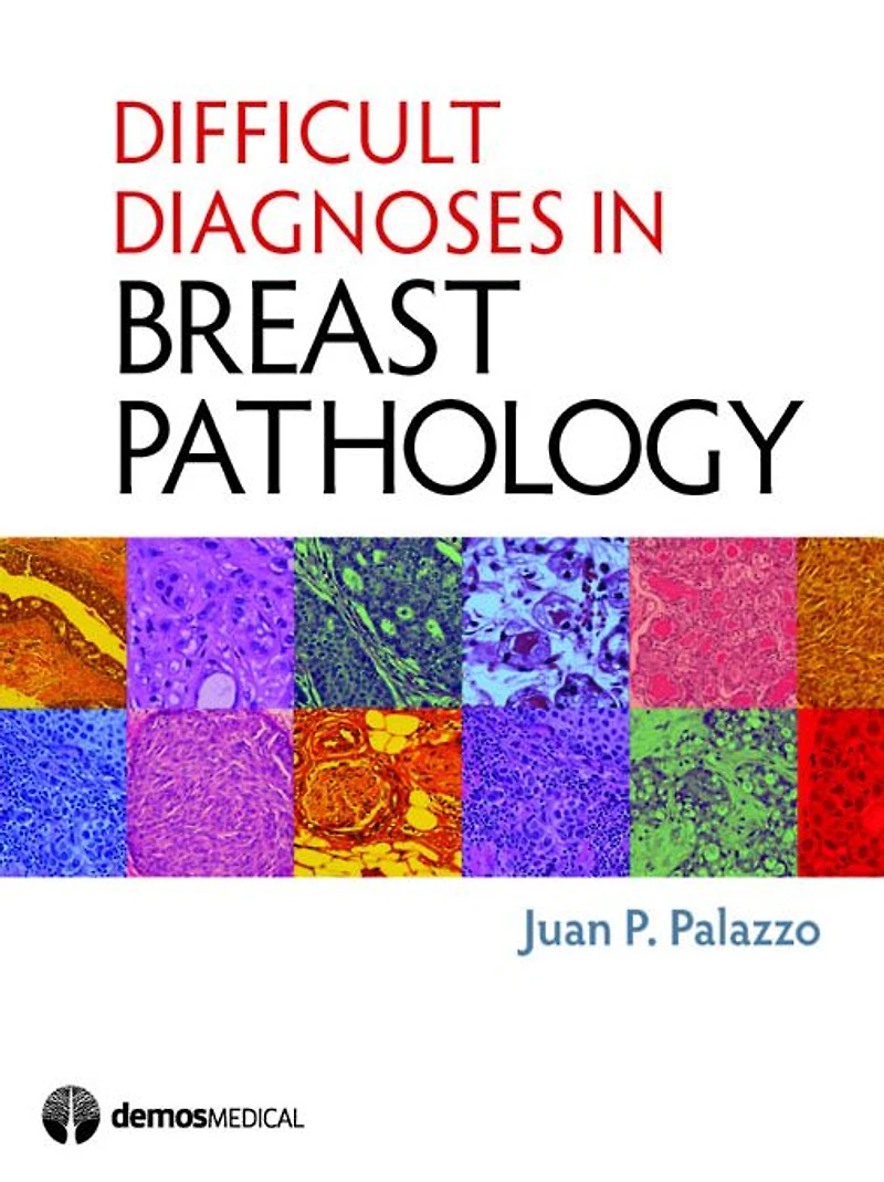 Difficult Diagnoses Breast Pathology