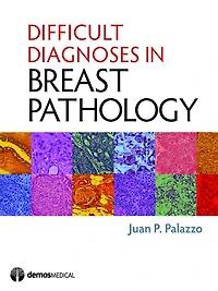 Difficult Diagnoses Breast Pathology