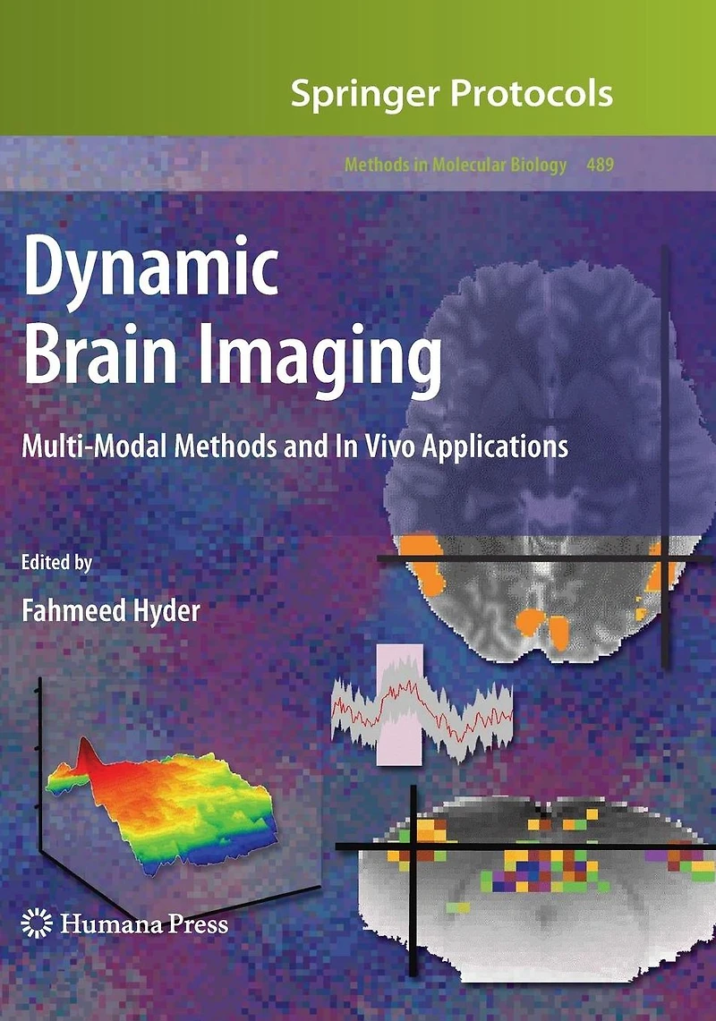 Dynamic Brain Imaging: Multi-Modal Methods and In Vivo Applications