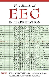 Handbook of EEG Interpretation