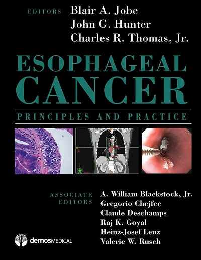 Esophageal Cancer: Principles and Practice