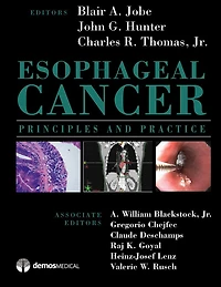 Esophageal Cancer: Principles and Practice