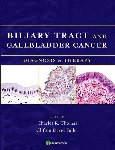 Biliary Tract and Gallbladder Cancer: Diagnosis and Therapy