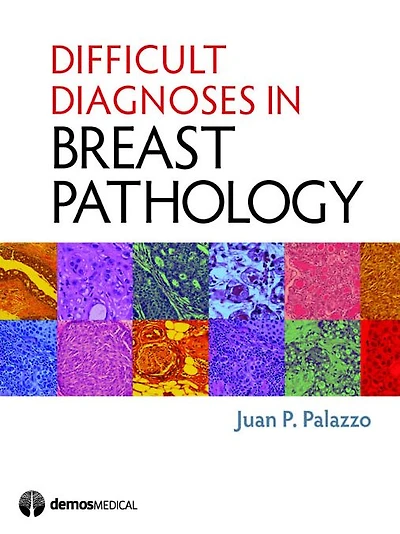 Difficult Diagnoses Breast Pathology