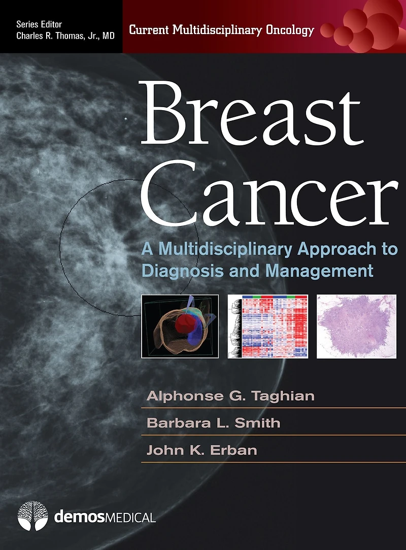 Breast Cancer: A Multidisciplinary Approach to Diagnosis and Management