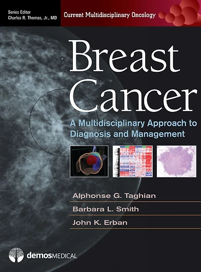 Breast Cancer: A Multidisciplinary Approach to Diagnosis and Management