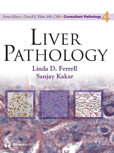 Liver Pathology