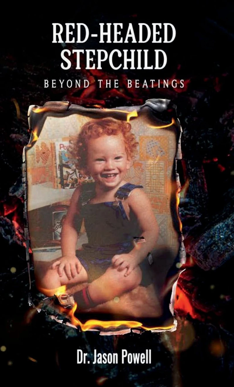 RED-HEADED STEPCHILD