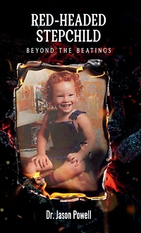 RED-HEADED STEPCHILD