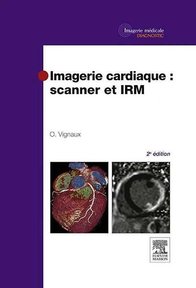 Imagerie cardiaque : scanner et IRM